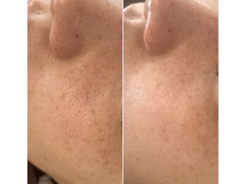 イロドリ(irodori)/ジュエリーピール♪