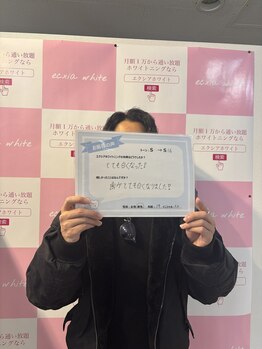 エクシアホワイトニング 前橋店/お客様の声