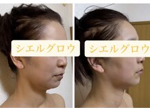 シエルグロウ(CielGrow)/小顔