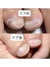 ハンドケアコース(整爪・甘皮処理・オイル)