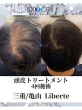 リベルテ(Liberte)/プロセル頭皮トリートメント
