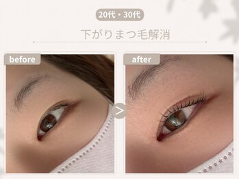 アイラッシュサロン ルッカ(eyelash salon Lucca)/下がりまつ毛解消