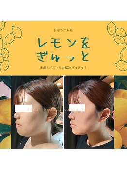 アリア/大人気のレモンボトル