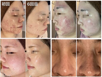 エヌエースキン たまプラーザ店(NAskin)の写真