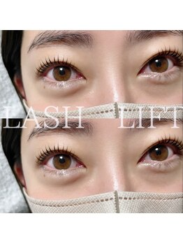 アール(R)/ラッシュリスト