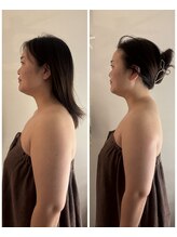 スワフルール(soi Fleur)/黄金比小顔全身コルギ