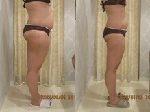 プロラボスパ 新宿店/30代前半　症例写真