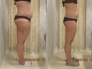 プロラボスパ 新宿店/30代前半 症例写真