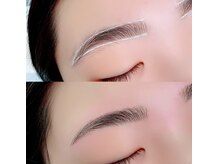 完全個室でしっかりとカウンセリングしお悩みを解消します！