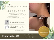 今、話題の<レモンボトル>導入。小顔コースはコチラが人気