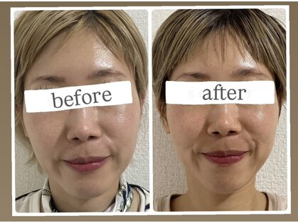 骨格美容サロンの写真