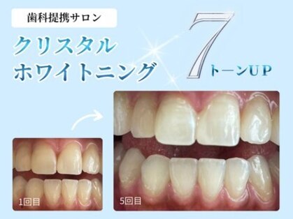 ベル(BEL)の写真