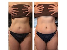 カロン(Kalon)/上半身痩せ