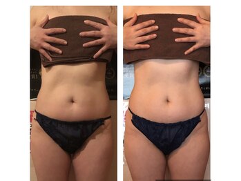 カロン(Kalon)/上半身痩せ