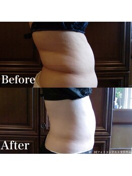 ビューティーサロン アンジュエール/お肌は滑らかに脂肪は引き締め☆