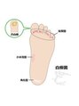Dr.巻き爪 天神院 爪の症状についてブログにて紹介!