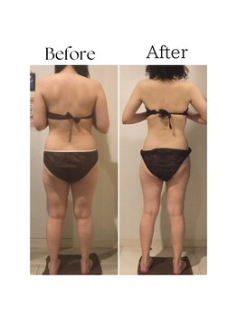 ラヴィニティ 自由が丘店(Lavinity)/【40代】ビフォー、アフター