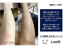 カスミ板橋ベルミーランド/お肌の悩みにも♪