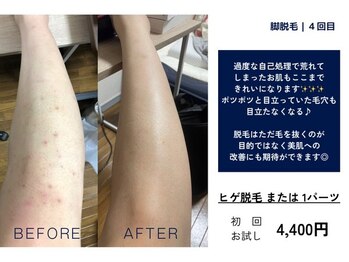 カスミ板橋ベルミーランド/お肌の悩みにも♪