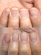 マリーロール 梅田店(Marie Laure)/深爪矯正/自爪育成/ネイルケア