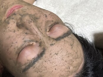 ジョアン(Johan)/ニキビケアもお任せください^^