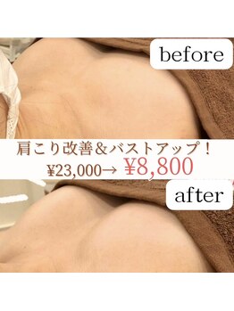 ウンスイスパ(UNSUI SPA)の写真/【ふわふわボリュームアップバスト】結果重視★育乳バストケアで小胸さんでもデコルテからふっくらバスト♪