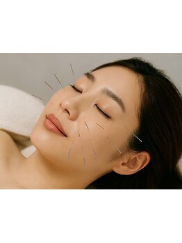 鍼灸施術を受けたい