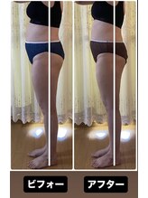 ヒヨリ(hiyori)/ちゃんと痩せるを実感