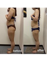 リラクラージュ(Ri Ra Courage)/ 30代３ヶ月後