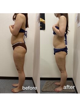 リラクラージュ(Ri Ra Courage)/ 30代3ヶ月後