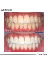 シュシュ(chouchou)/高濃度医療提携機関ジェル比較