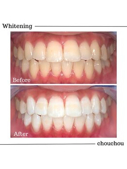 シュシュ(chouchou)/高濃度医療提携機関ジェル比較