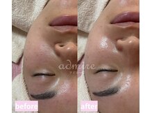 アドミーロ/無加工でも自信の肌へ★