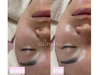 アドミーロ/無加工でも自信の肌へ★