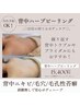 【背中ニキビ/シミ/毛孔性苔癬】ボディハーブピーリング<背面集中ケア>90分