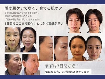 ベリル(BERYL)/SNSで話題の化粧品が凄い!