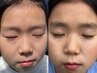 【お子様の強い痒み赤み】 慢性肌トラブル改善