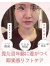 見た目年齢に差がつく！直後から引き上げ！【すっきりリフトアップコース】