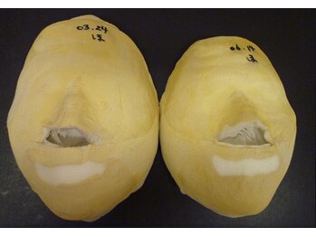 エスク(ESQUE)/石膏マスクビフォーアフター