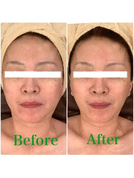 スペチアーレ 夙川/美肌と小顔を同時に叶える！