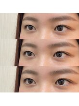 シアミス(SIAMIHS)/アップワードラッシュ