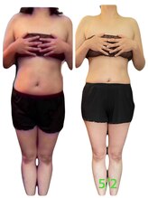 エステサロン ジュブリー/［40代痩身］