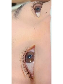 コア(Koa)/パリジェンヌアップリフト