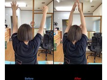 整体院輝/肩関節の可動域変化