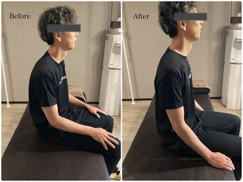 ワン ストレッチ(ONE stretch)/【40代男性before・after】