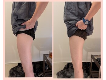 ワイズ(Y's)/美尻美脚コース8回目