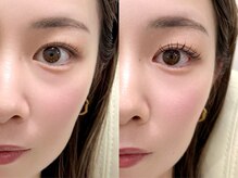 ズール(ZUL)/マツエク派？マツパ派？