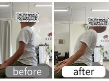 ナオル整体 大里院(NAORU整体)/40代男性　上を向く動作