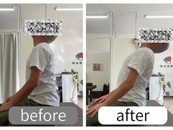 ナオル整体 大里院(NAORU整体)/40代男性 上を向く動作