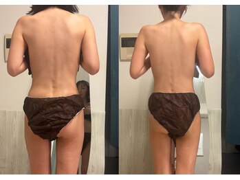 オーシャンブルーム 目黒(OceanBloom)/たった1回